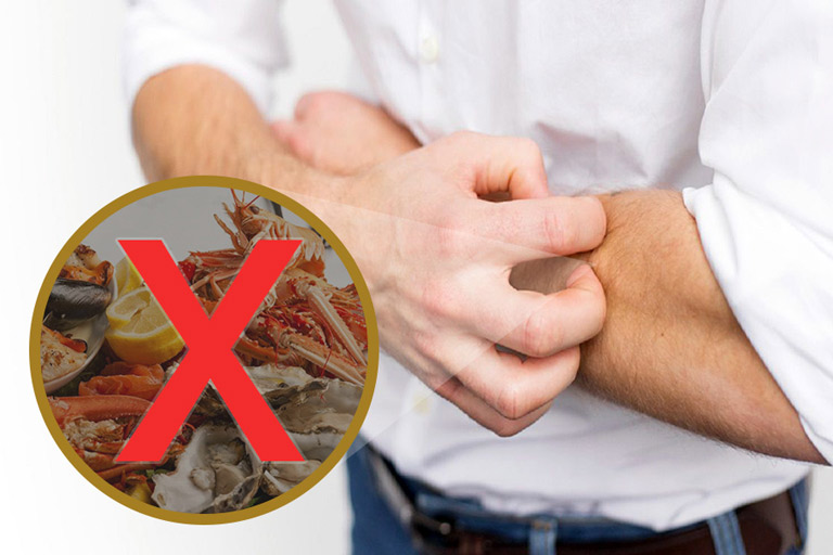 bị phong ngứa không nên ăn gì