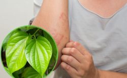 Chữa á sừng bằng lá trầu không