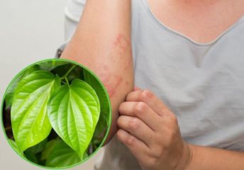 Chữa á sừng bằng lá trầu không