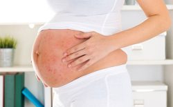 Bà bầu bị nổi mẩn đỏ ở bụng không ngứa: Mẹ không được chủ quan