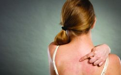 mẹ sau sinh bị mẩn ngứa