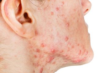 mun-mu-co-nen-nan-khong