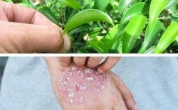Trị Eczema bằng lá móng tay như thế nào?