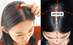 Huyệt bách hội: Cách xác định vị trí, tác dụng trong trị liệu