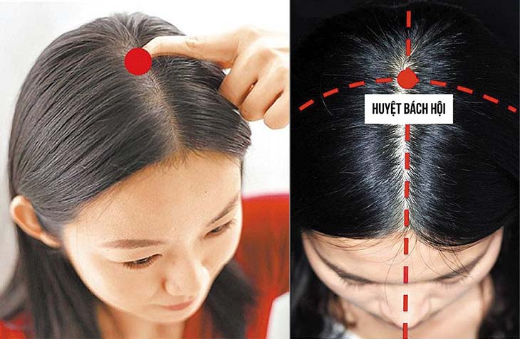 Huyệt bách hội: Cách xác định vị trí, tác dụng trong trị liệu
