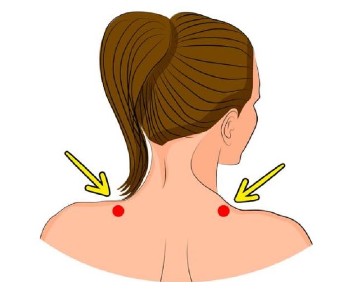 Bấm huyệt kiên tỉnh trị nhiều bệnh ở lưng và cổ vai gáy
