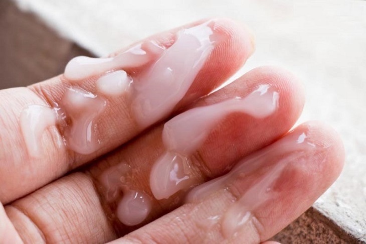 Tinh trùng vón cục: Nguyên nhân, triệu chứng và cách điều trị