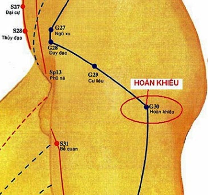 Bấm huyệt hoàn khiêu giúp hỗ trợ điều trị tình trạng đau thần kinh tọa