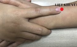 Hình ảnh huyệt Liệt Khuyết