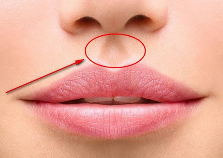 Vị trí của huyệt nhân trung là nằm ở vùng môi trên
