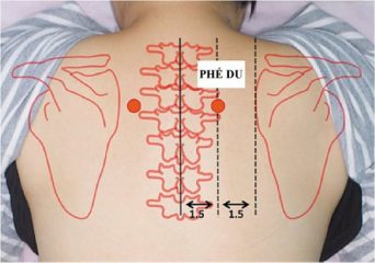 Vị trí của huyệt phế du được xác định như hình