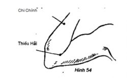 Huyệt Thiếu Hải