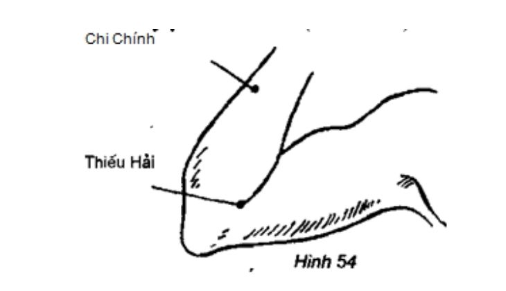 Huyệt Thiếu Hải