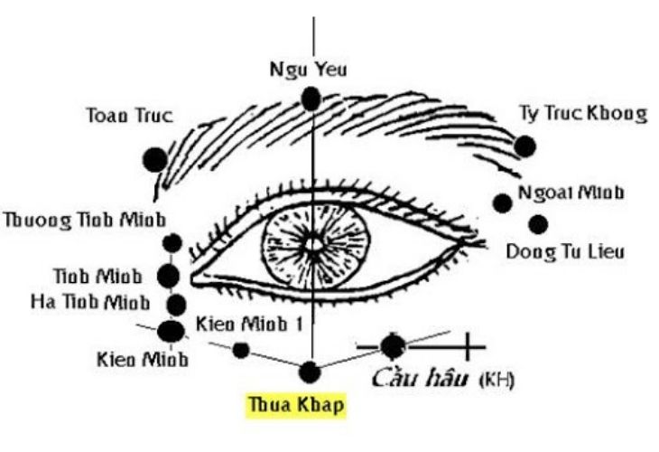 Huyệt Thừa Khấp được phối với nhiều huyệt đạo khác nhằm điều trị các bệnh lý về mắt