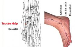Bạn nên tìm hiểu kỹ về huyệt Túc Lâm Khấp trước khi thực hiện day ấn hoặc châm cứu