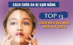 Cách chữa da bị sạm nắng