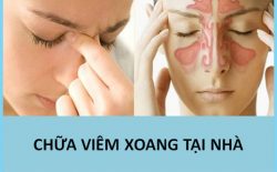 Hiện nay có nhiều mẹo chữa viêm xoang tại nhà vẫn được người bệnh tin dùng