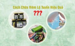 Cách chữa viêm lộ tuyến cổ tử cung