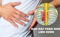 Đau dây thần kinh liên sườn