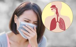 Ho có đờm là tình trạng ho và tống dịch đờm trong cổ họng ra khỏi cơ thể