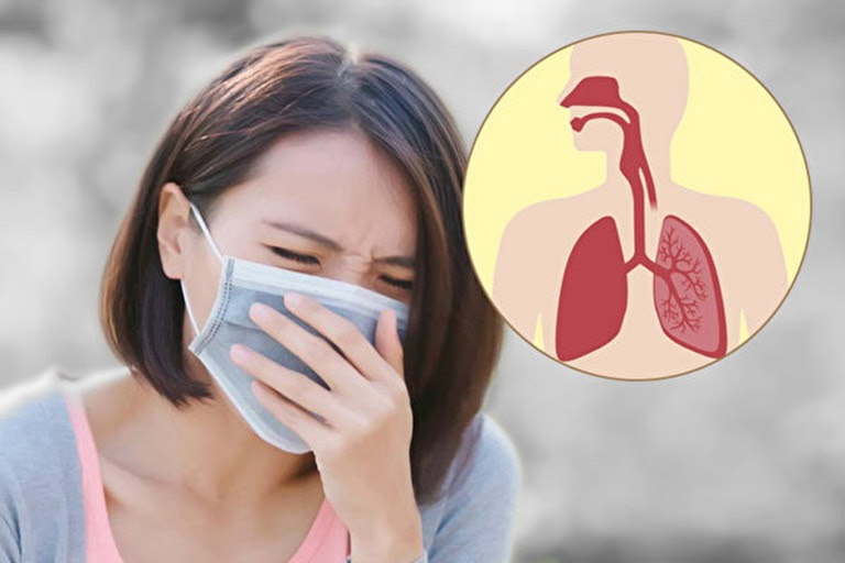 Ho có đờm là tình trạng ho và tống dịch đờm trong cổ họng ra khỏi cơ thể