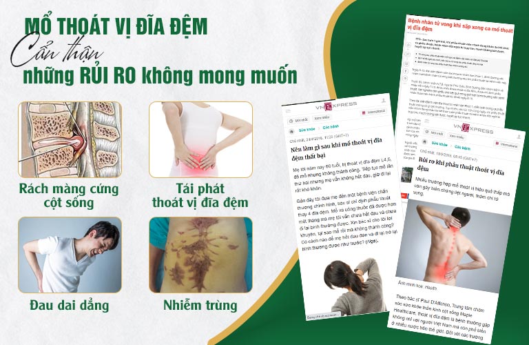 Những Rủi Ro Khôn Lường Khi Mổ Thoát Vị Đĩa Đệm Và Cách Xử Lý An Toàn Bằng Thảo Dược