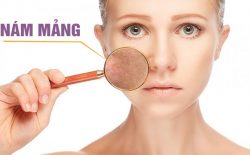 Nám mảng