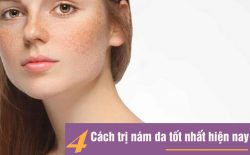 Trị nám da