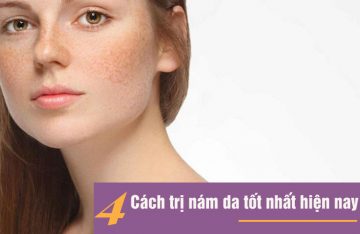Trị nám da