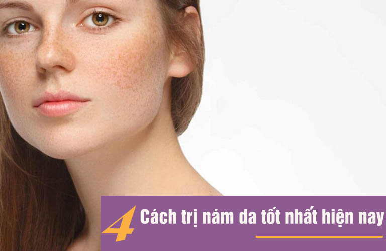 Trị nám da
