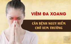 Viêm đa xoang