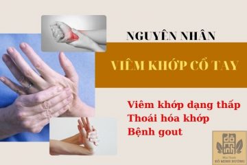 Nguyên nhân dẫn đến viêm sưng tại khớp cổ tay do thoái hóa