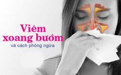 Ngày càng có nhiều người bị viêm xoang bướm