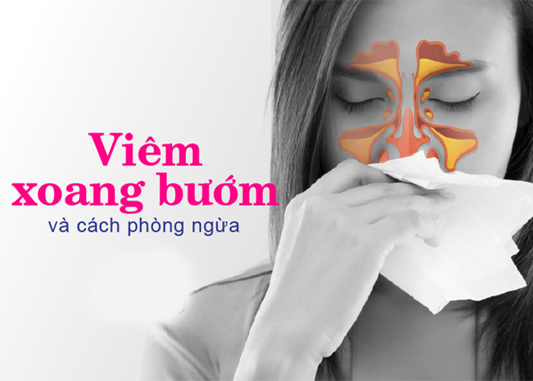 Ngày càng có nhiều người bị viêm xoang bướm