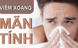 Viêm xoang mạn tính là căn bệnh khó chữa