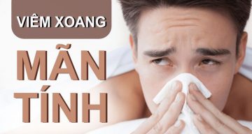 Viêm xoang mạn tính là căn bệnh khó chữa