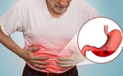 Xuất Huyết Dạ Dày Là Gì? Cách Xử Lý Bệnh Tốt Nhất Hiện Nay