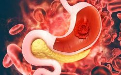 Vị trí đau dạ dày nằm ở đâu và giải pháp nhanh gọn nhất từ YHCT