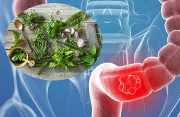 Cách chữa bệnh đại tràng tại nhà hiệu quả