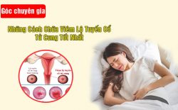 Cách chữa viêm lộ tuyến cổ tử cung