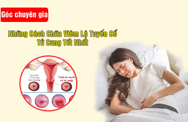Cách chữa viêm lộ tuyến cổ tử cung
