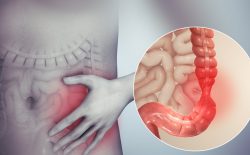 Hội chứng ruột kích thích là gì? Nguyên nhân, triệu chứng và phương pháp điều trị AN TOÀN
