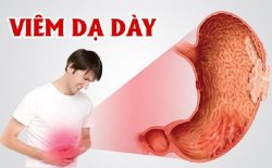 Viêm dạ dày tá tràng là bệnh lý phổ biến ở đường tiêu hóa