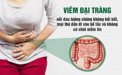 Viêm Đại Tràng Là Gì? Dấu Hiệu Và Cách Điều Trị Bệnh Hiệu Quả