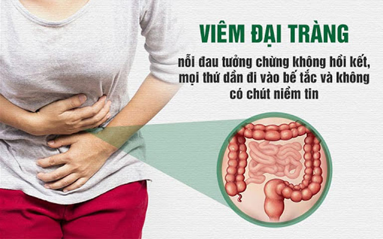 Viêm Đại Tràng Là Gì? Dấu Hiệu Và Cách Điều Trị Bệnh Hiệu Quả